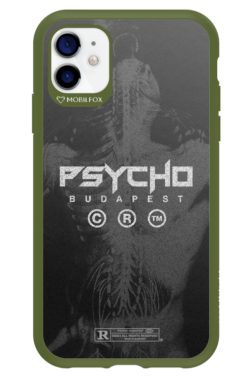 X-Ray - Apple iPhone 11