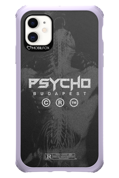 X-Ray - Apple iPhone 11