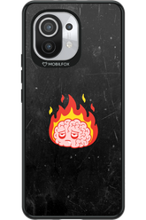 My brain - Xiaomi Mi 11 5G
