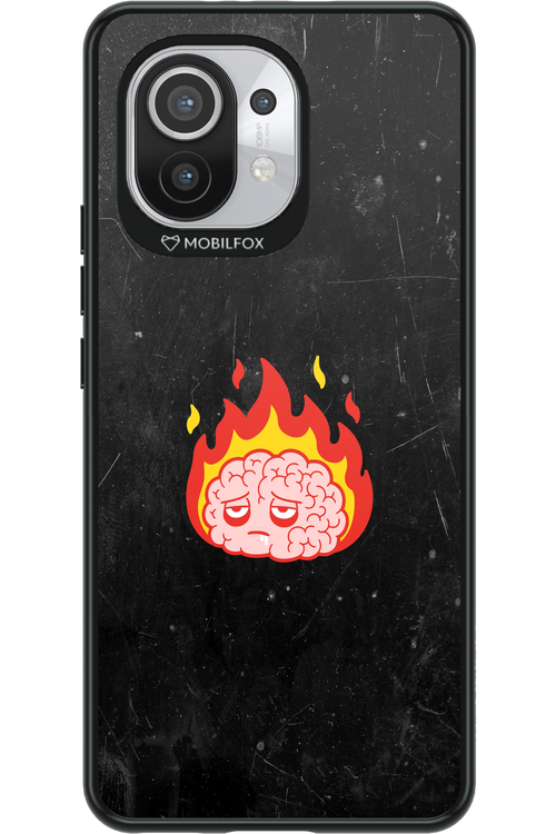 My brain - Xiaomi Mi 11 5G