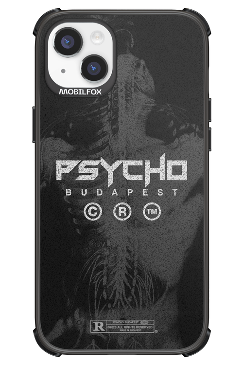 X-Ray - Apple iPhone 14 Plus
