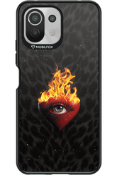 Shit happens - Xiaomi Mi 11 Lite (2021)