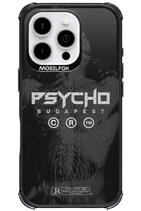 X-Ray - Apple iPhone 16 Pro