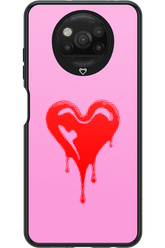 Heart Pink - Xiaomi Poco X3 NFC