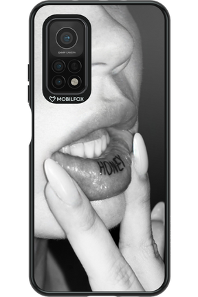 Lip Secret 2.0 - Xiaomi Mi 10T 5G