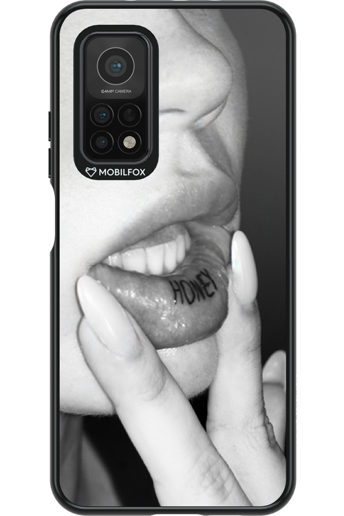 Lip Secret 2.0 - Xiaomi Mi 10T 5G