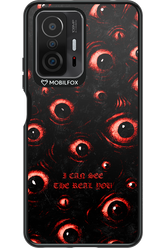 The Watchers - Xiaomi Mi 11T