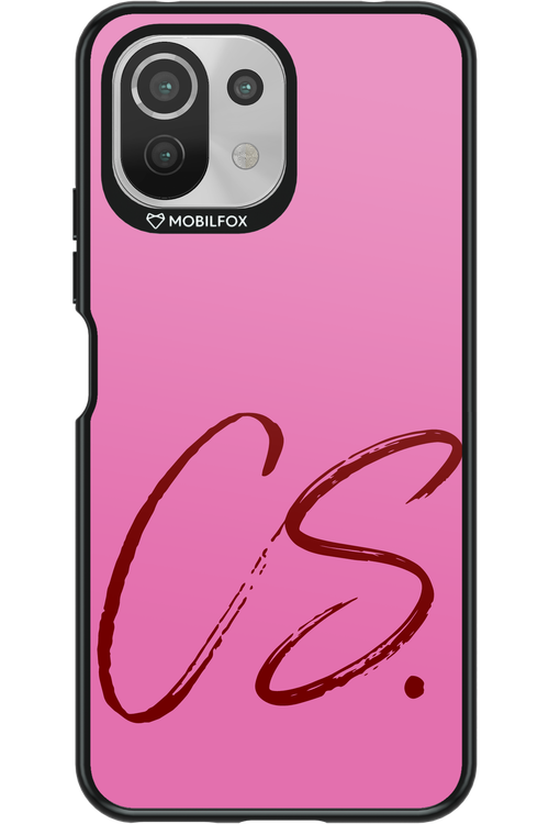 (Sorbet) CS 2.0 - Xiaomi Mi 11 Lite (2021)