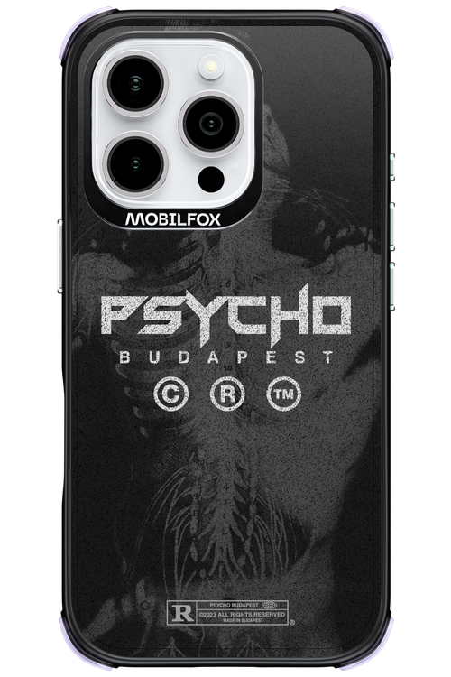 X-Ray - Apple iPhone 16 Pro