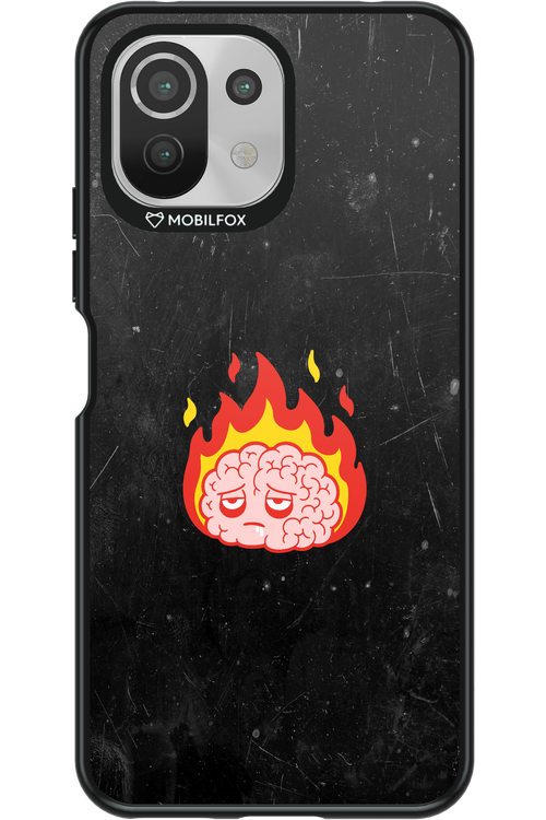 My brain - Xiaomi Mi 11 Lite (2021)