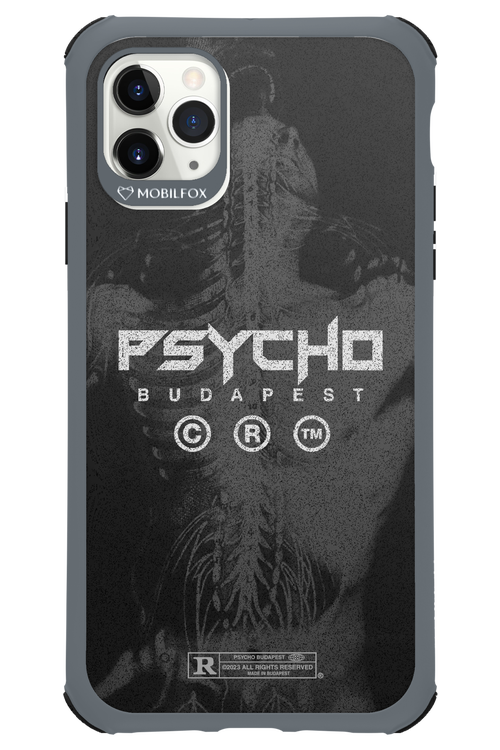 X-Ray - Apple iPhone 11 Pro Max