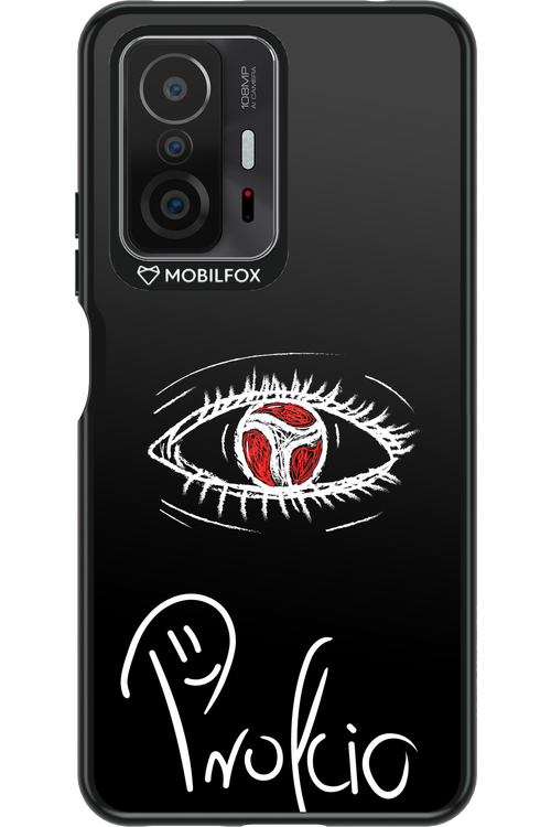 Profcio Eye - Xiaomi Mi 11T Pro