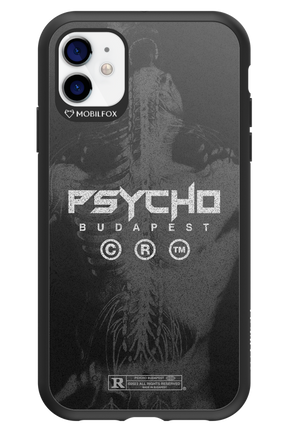 X-Ray - Apple iPhone 11