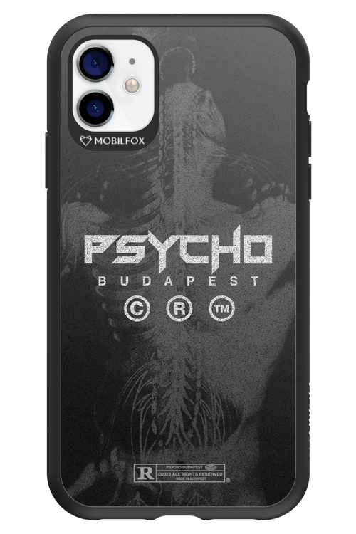X-Ray - Apple iPhone 11