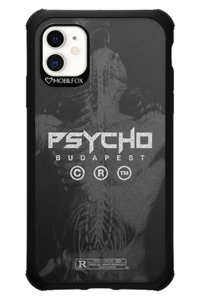 X-Ray - Apple iPhone 11
