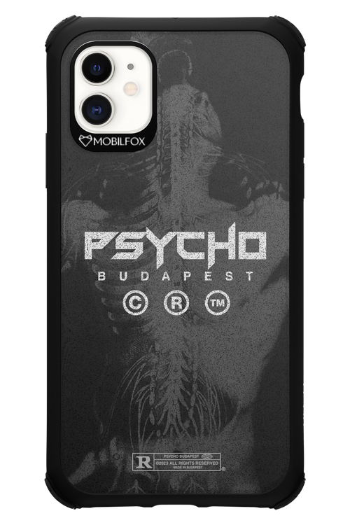 X-Ray - Apple iPhone 11