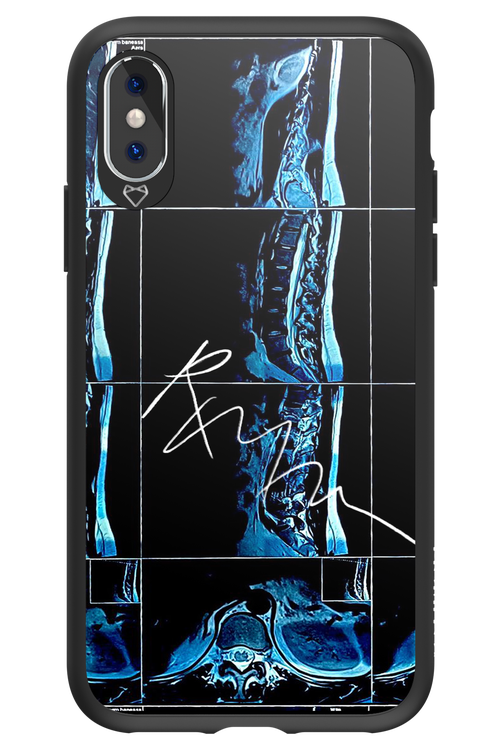 RMN Scolioza 2.0 - Apple iPhone X