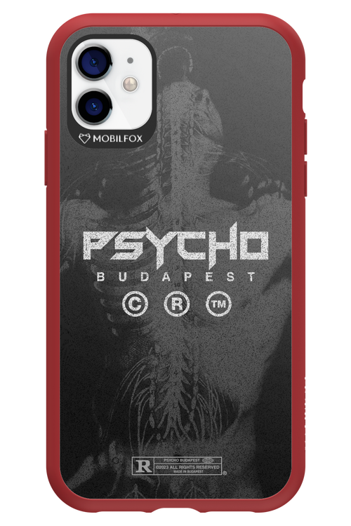 X-Ray - Apple iPhone 11