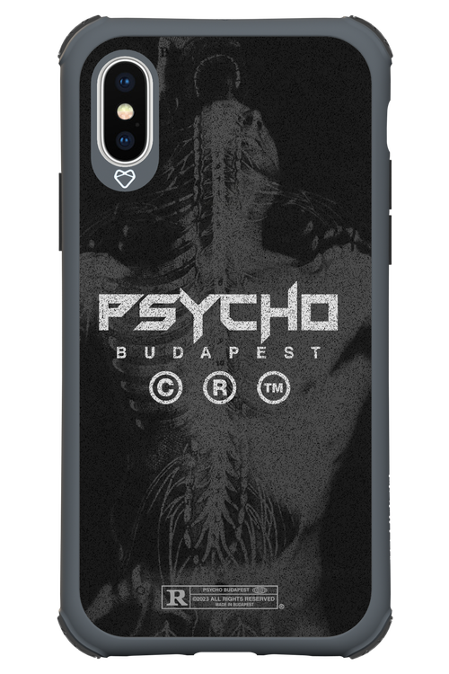 X-Ray - Apple iPhone XS