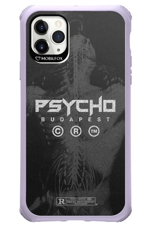 X-Ray - Apple iPhone 11 Pro Max