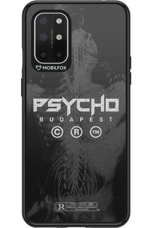 X-Ray - OnePlus 8T