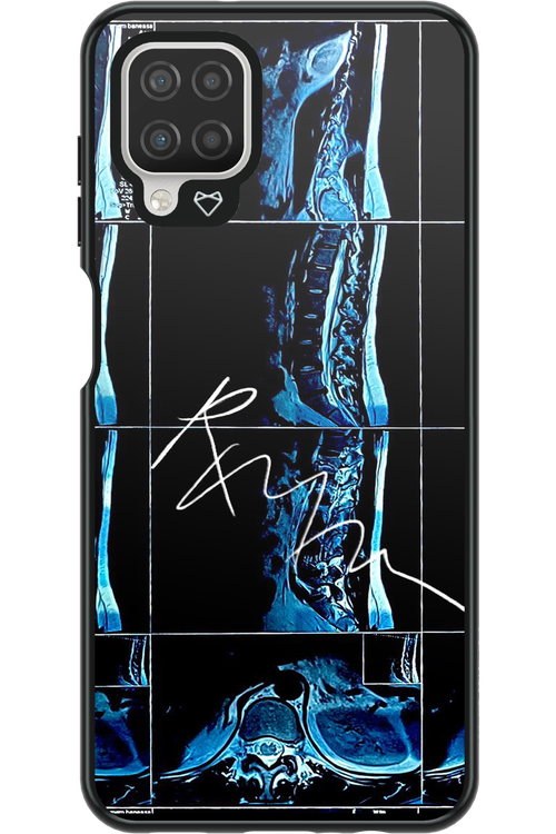 RMN Scolioza 2.0 - Samsung Galaxy A12