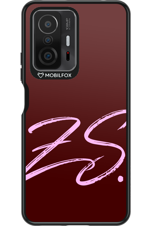 (Dark Blush) ZS 2.0 - Xiaomi Mi 11T