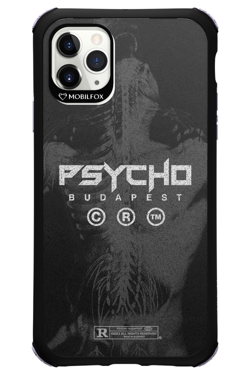 X-Ray - Apple iPhone 11 Pro Max