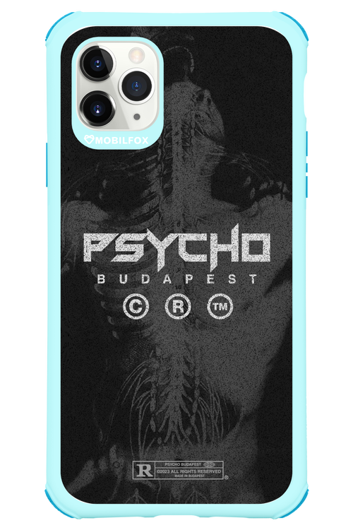 X-Ray - Apple iPhone 11 Pro Max