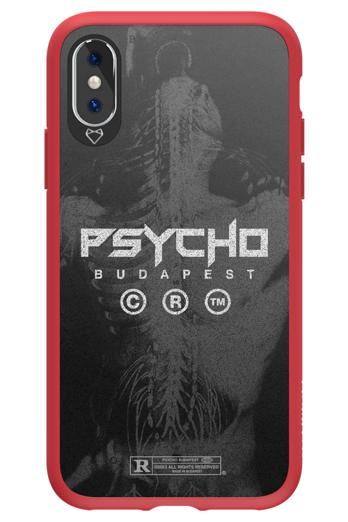 X-Ray - Apple iPhone XS