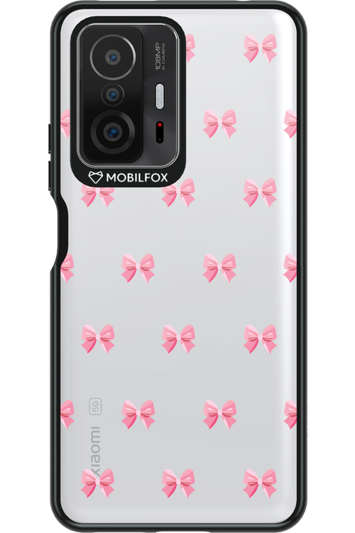 Pinky Bow 2.0 - Xiaomi Mi 11T