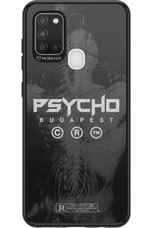 X-Ray - Samsung Galaxy A21 S