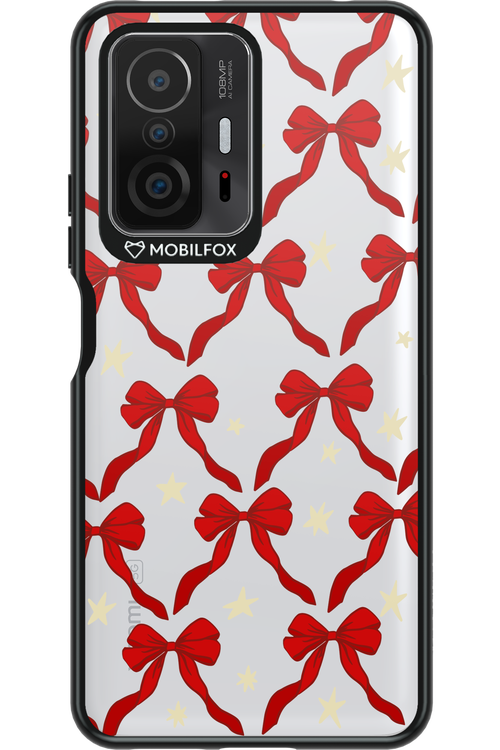 Bow & Stars (Transparent) - Xiaomi Mi 11T