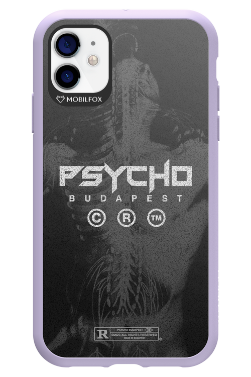 X-Ray - Apple iPhone 11