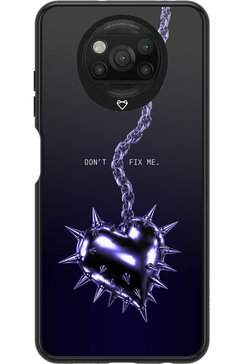 Don't fix me 2.0 - Xiaomi Poco X3 NFC