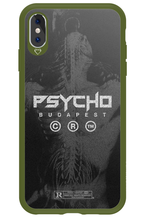 X-Ray - Apple iPhone XS Max