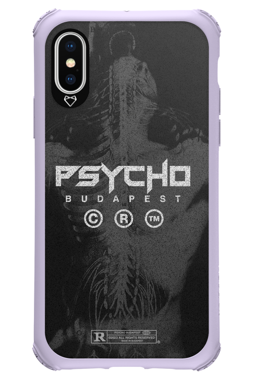 X-Ray - Apple iPhone XS
