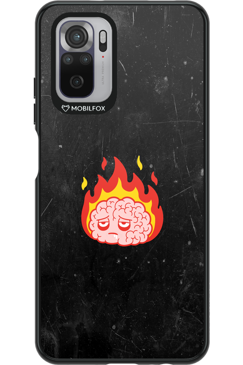 My brain - Xiaomi Redmi Note 10