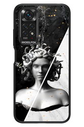 Medusa - Xiaomi Redmi Note 11/11S 4G