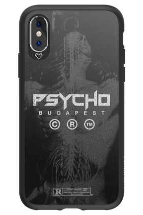 X-Ray - Apple iPhone XS