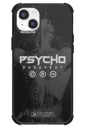 X-Ray - Apple iPhone 14 Plus