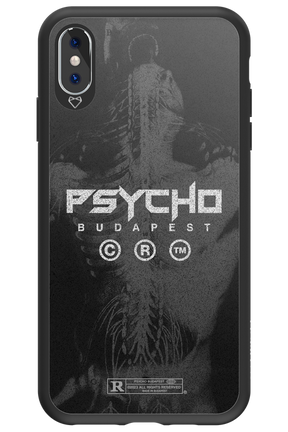 X-Ray - Apple iPhone XS Max