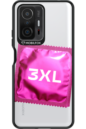 3XL 2.0 - Xiaomi Mi 11T
