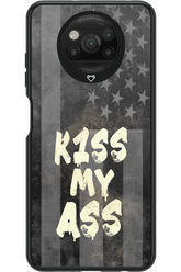 KISS II 2.0 - Xiaomi Poco X3 Pro