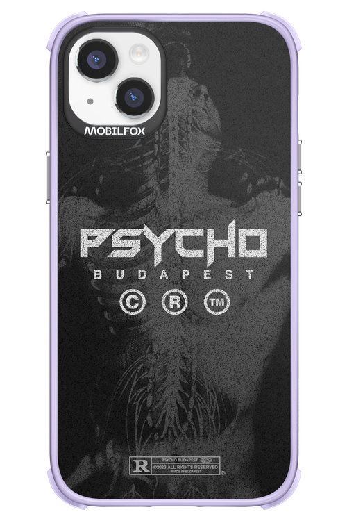 X-Ray - Apple iPhone 14 Plus