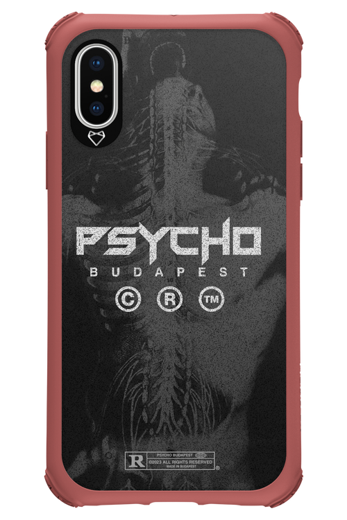 X-Ray - Apple iPhone XS