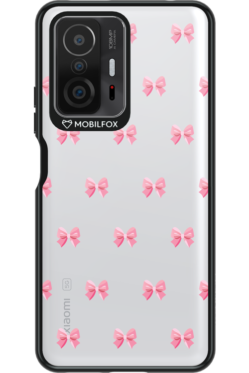 Pinky Bow 2.0 - Xiaomi Mi 11T Pro