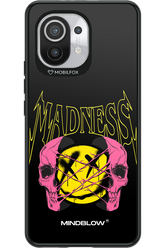 Madness Mindblow - Xiaomi Mi 11 5G