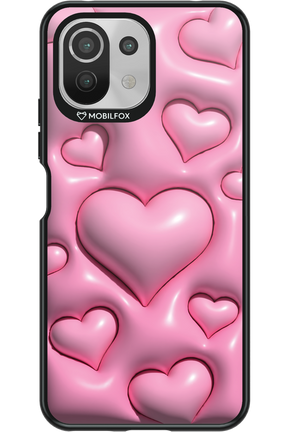 Hearts - Xiaomi Mi 11 Lite (2021)