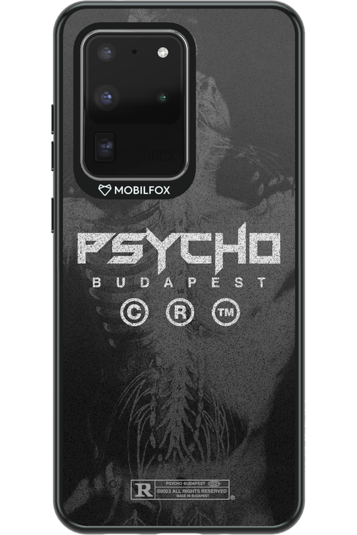 X-Ray - Samsung Galaxy S20 Ultra 5G